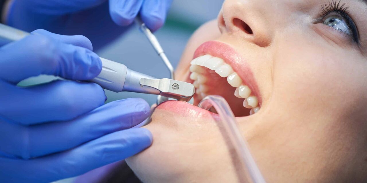 How Long Does a Dental Cleaning Take? A Complete Guide