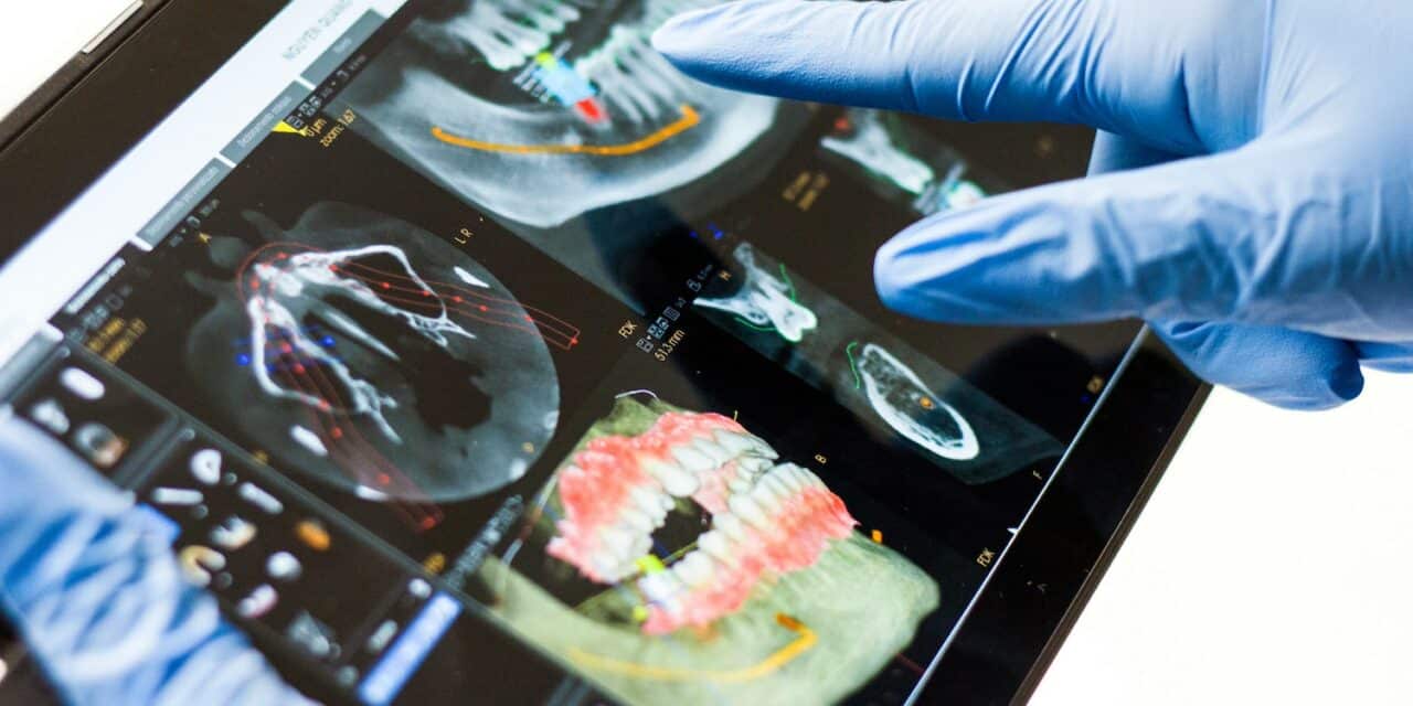 How Often Should You Get Dental X-Rays? Expert Guidelines
