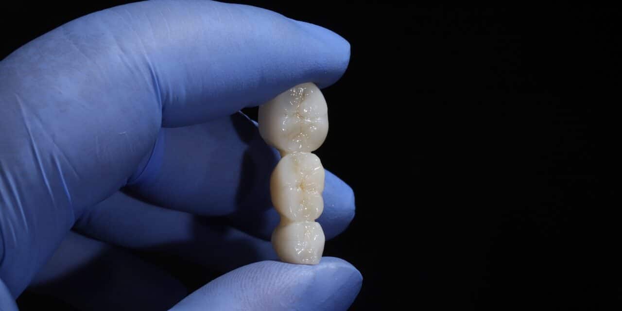 Dental Crowns Las Vegas: Overview and Care