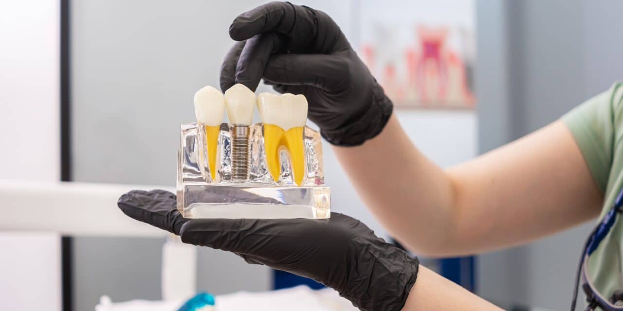 Do Dental Implants Hurt? What to Really Expect